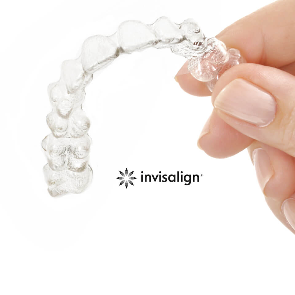 Invisalign - the transparent braces for adults